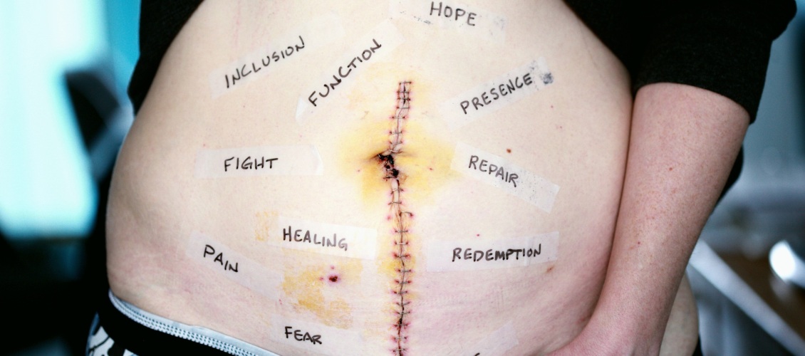 07 Proteger los tejidos. Trabajar las cicatrices