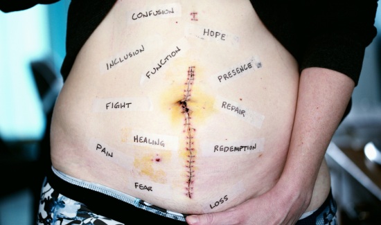 07 Proteger los tejidos. Trabajar las cicatrices