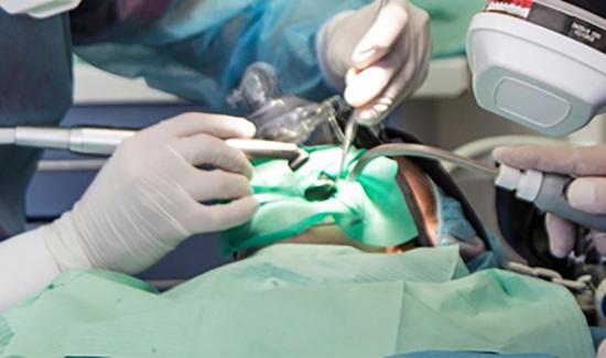 03 Amalgamas dentales